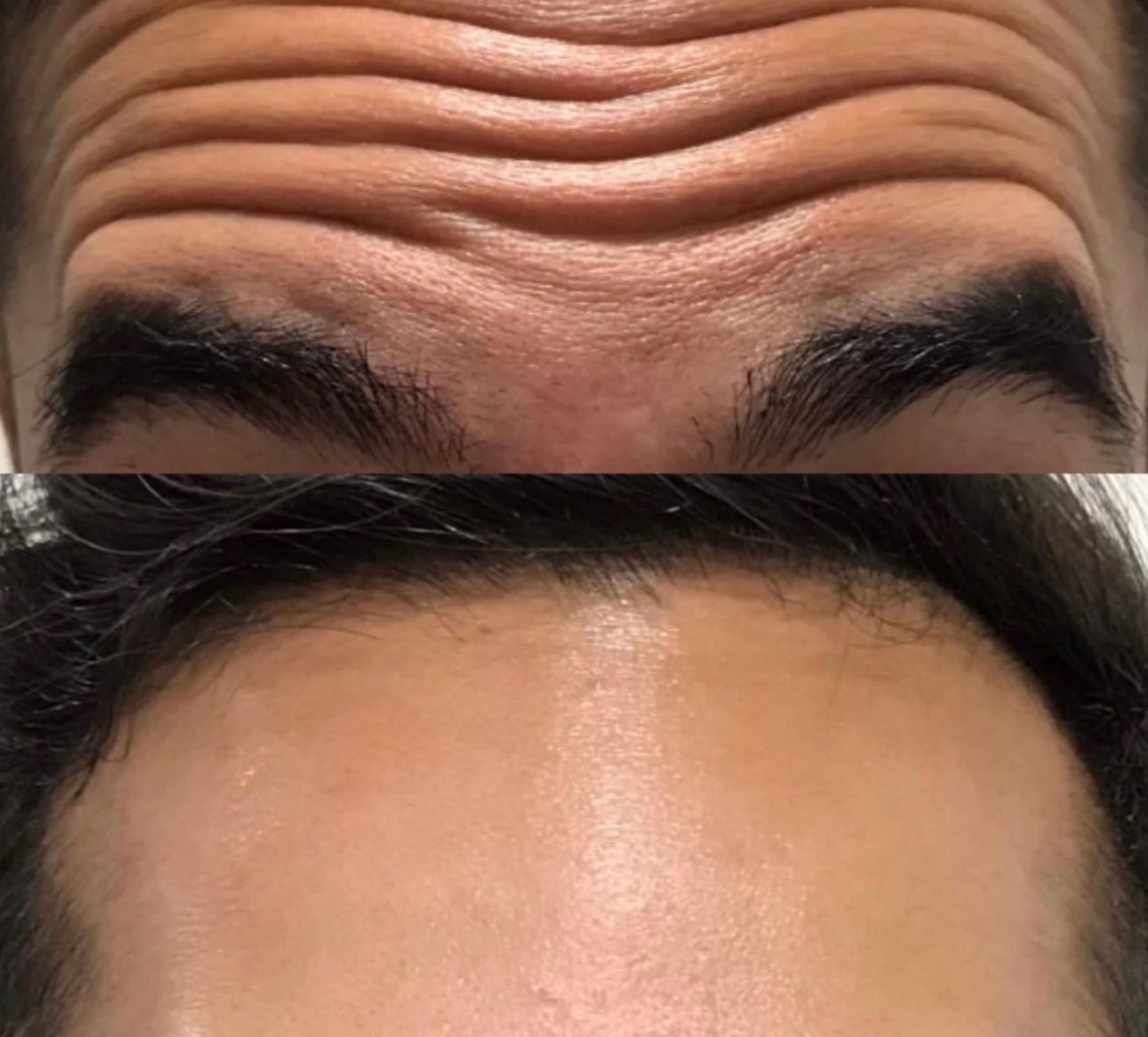 Antes y Después 1