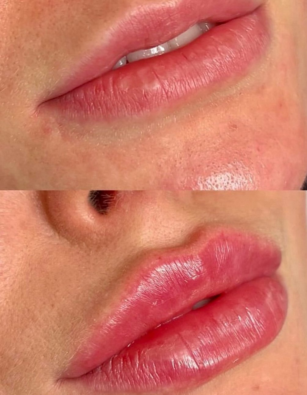 Antes y Después 2
