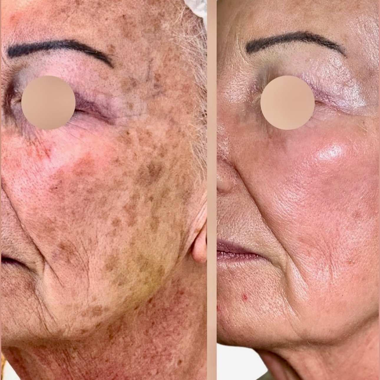 Antes y Después 3